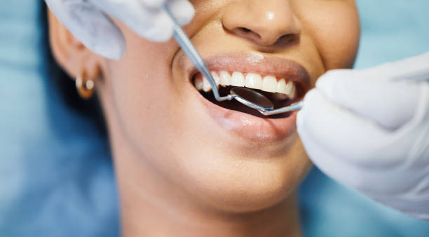 Best Emergency Cosmetic Dentistry (e.g., broken veneers) in Piedmont, OK